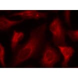 Immunofluorescence - p53 (Phospho-Ser33) Antibody from Signalway Antibody (11097) - Antibodies.com