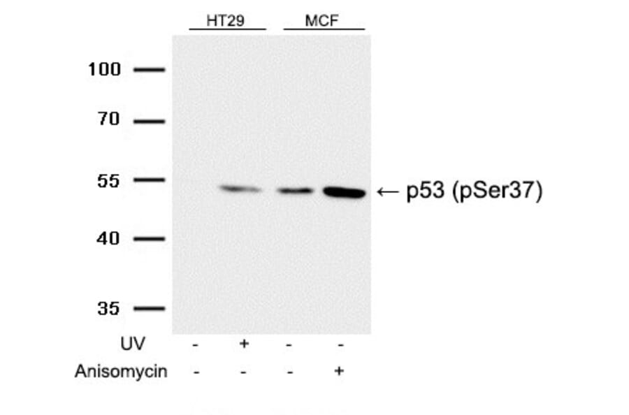 Western blot - p53 (Phospho-Ser37) Antibody from Signalway Antibody (11098) - Antibodies.com