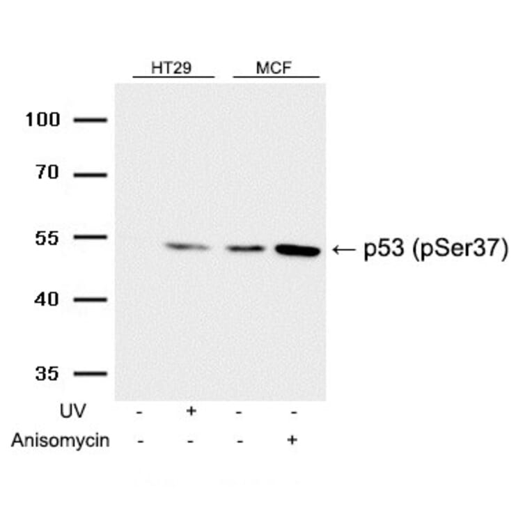 Western blot - p53 (Phospho-Ser37) Antibody from Signalway Antibody (11098) - Antibodies.com