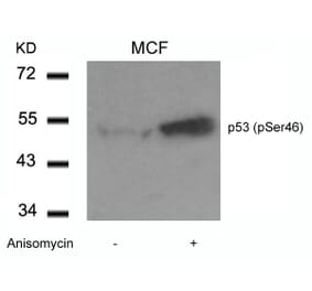 Western blot - p53 (Phospho-Ser46) Antibody from Signalway Antibody (11099) - Antibodies.com