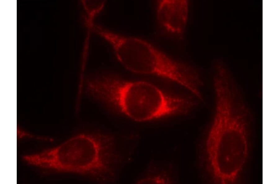 Immunofluorescence - p53 (Phospho-Ser46) Antibody from Signalway Antibody (11099) - Antibodies.com