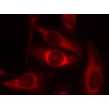 Immunofluorescence - p53 (Phospho-Ser46) Antibody from Signalway Antibody (11099) - Antibodies.com
