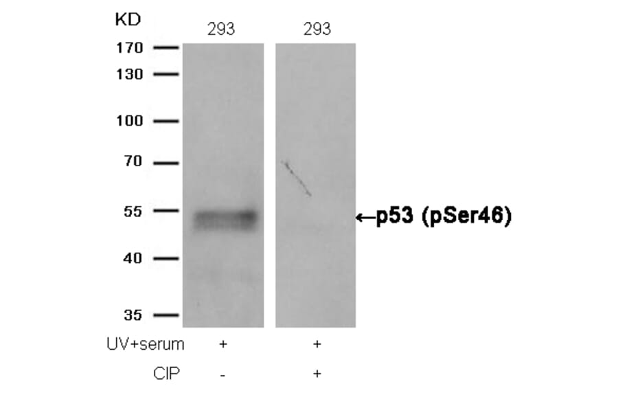 Western blot - p53 (Phospho-Ser46) Antibody from Signalway Antibody (11099) - Antibodies.com
