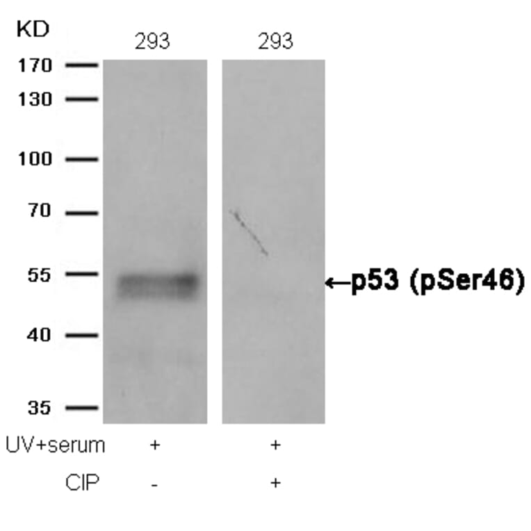 Western blot - p53 (Phospho-Ser46) Antibody from Signalway Antibody (11099) - Antibodies.com