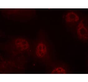 Immunofluorescence - Myc (Phospho-Ser62) Antibody from Signalway Antibody (11311) - Antibodies.com