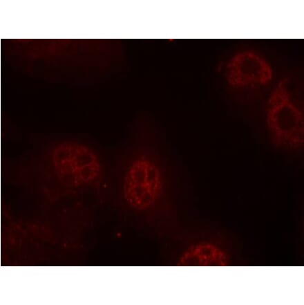 Immunofluorescence - Myc (Phospho-Ser62) Antibody from Signalway Antibody (11311) - Antibodies.com