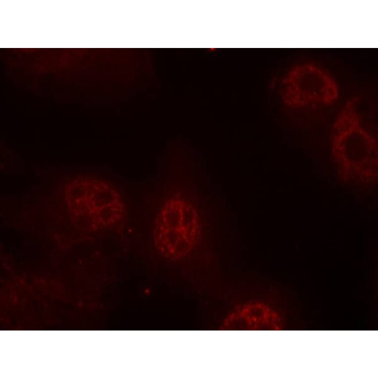 Immunofluorescence - Myc (Phospho-Ser62) Antibody from Signalway Antibody (11311) - Antibodies.com