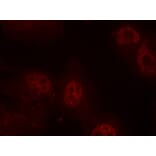 Immunofluorescence - Myc (Phospho-Ser62) Antibody from Signalway Antibody (11311) - Antibodies.com