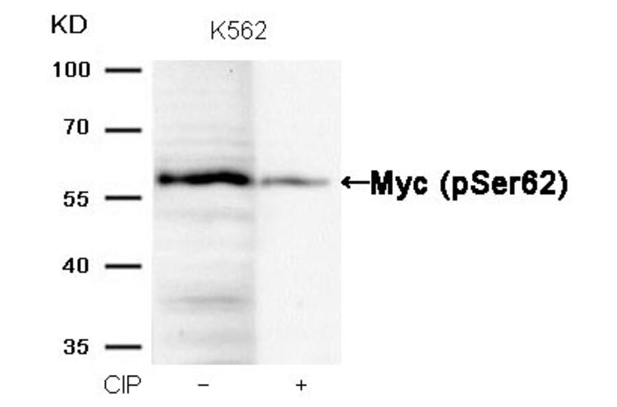 Western blot - Myc (Phospho-Ser62) Antibody from Signalway Antibody (11311) - Antibodies.com