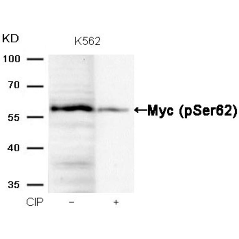 Western blot - Myc (Phospho-Ser62) Antibody from Signalway Antibody (11311) - Antibodies.com
