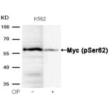 Western blot - Myc (Phospho-Ser62) Antibody from Signalway Antibody (11311) - Antibodies.com