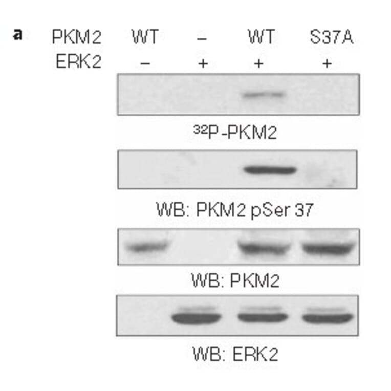 Western blot - PKM2 (phospho-Ser37) Antibody from Signalway Antibody (11456) - Antibodies.com