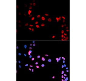 Immunofluorescence - MAX (Phospho-Ser11) antibody from Signalway Antibody (12170) - Antibodies.com