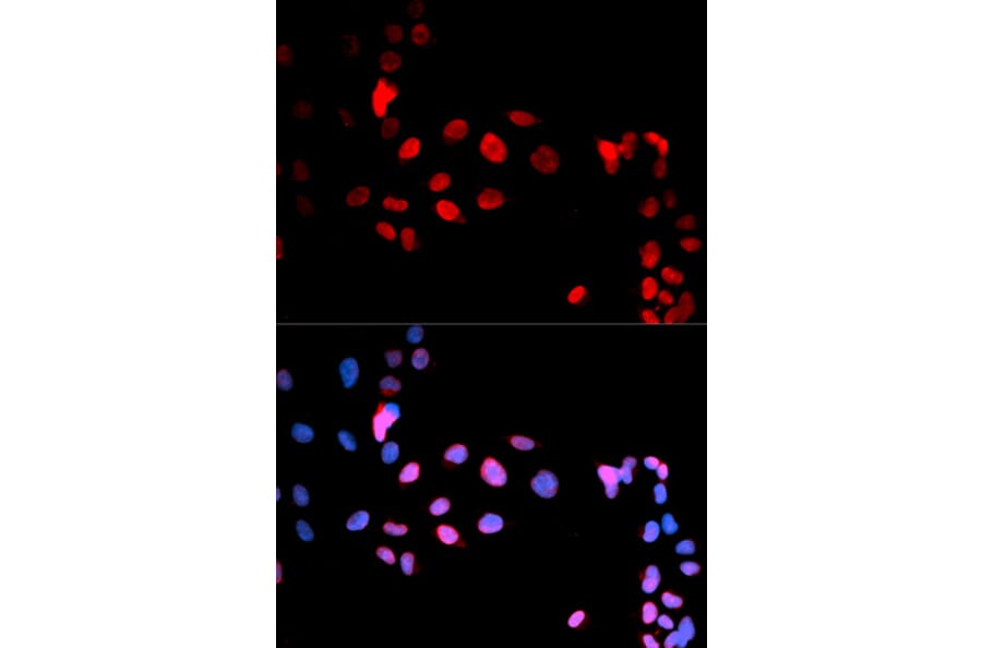 Immunofluorescence - MAX (Phospho-Ser11) antibody from Signalway Antibody (12170) - Antibodies.com