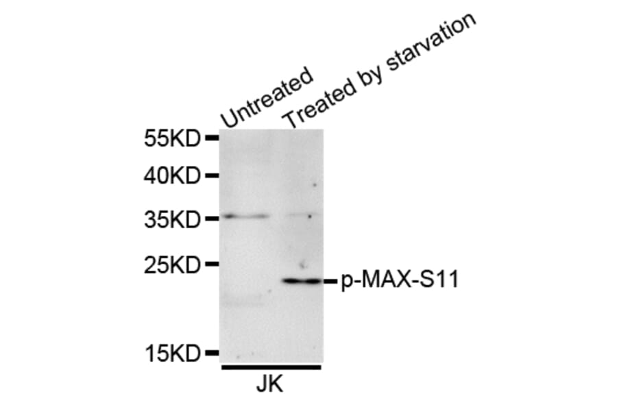Western blot - MAX (Phospho-Ser11) antibody from Signalway Antibody (12170) - Antibodies.com