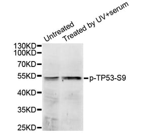 Western blot - TP53 (Phospho-Ser9) antibody from Signalway Antibody (12172) - Antibodies.com