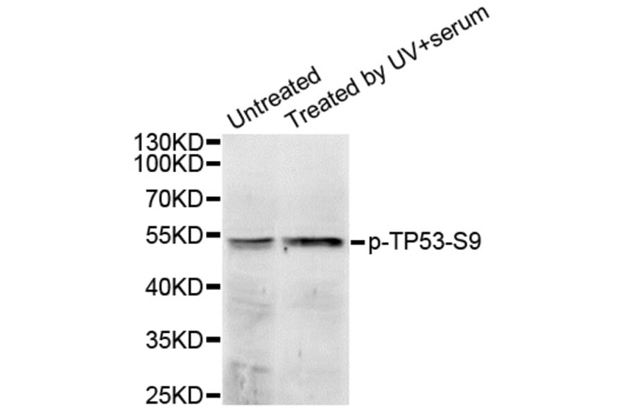 Western blot - TP53 (Phospho-Ser9) antibody from Signalway Antibody (12172) - Antibodies.com