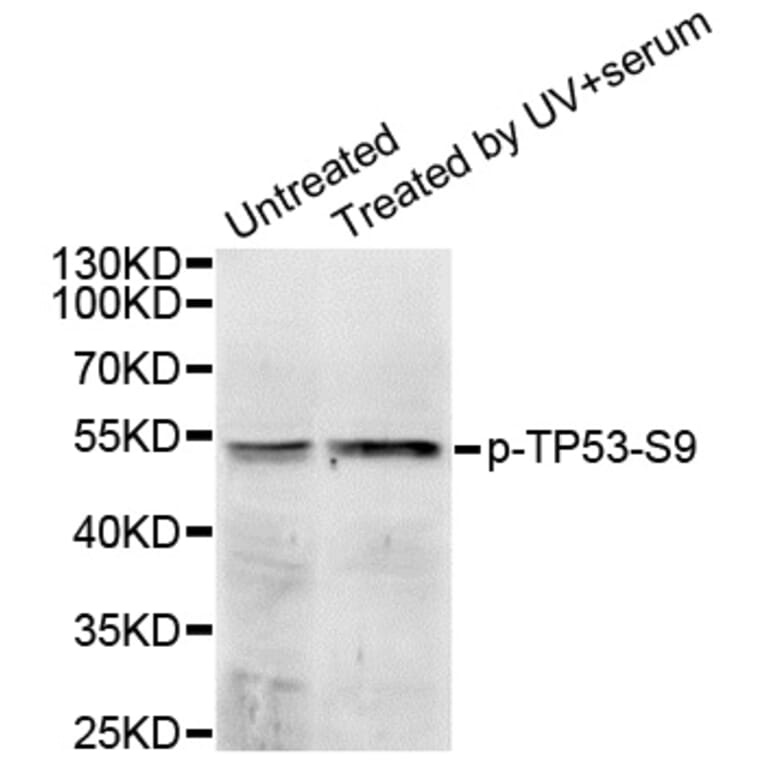 Western blot - TP53 (Phospho-Ser9) antibody from Signalway Antibody (12172) - Antibodies.com