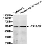 Western blot - TP53 (Phospho-Ser9) antibody from Signalway Antibody (12172) - Antibodies.com