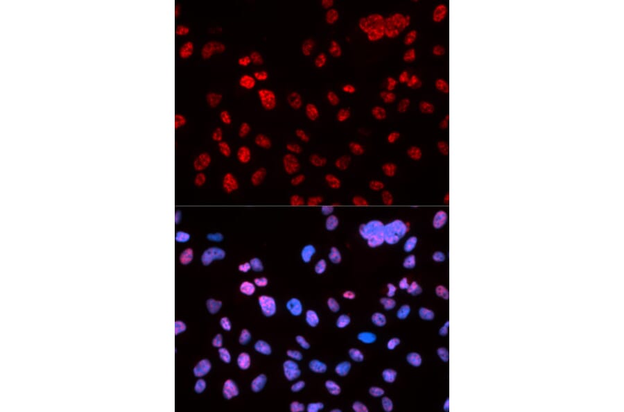 Immunofluorescence - TP53 (Phospho-Ser9) antibody from Signalway Antibody (12172) - Antibodies.com
