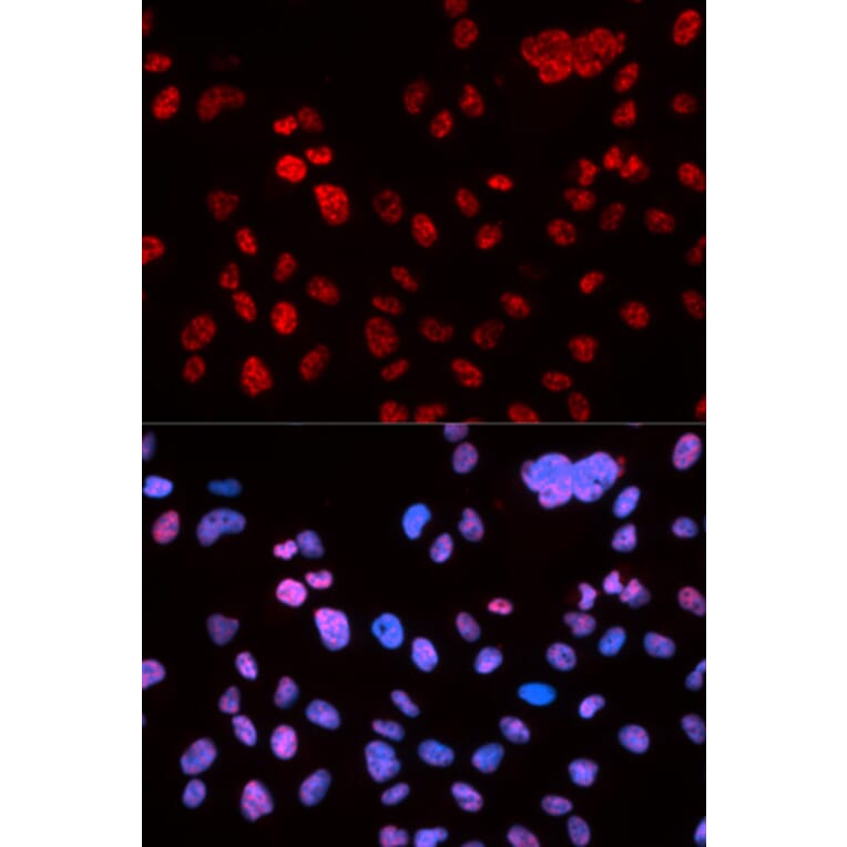 Immunofluorescence - TP53 (Phospho-Ser9) antibody from Signalway Antibody (12172) - Antibodies.com