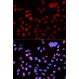 Immunofluorescence - TP53 (Phospho-Ser9) antibody from Signalway Antibody (12172) - Antibodies.com