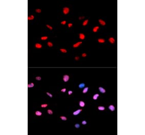 Immunofluorescence - RB (Phospho-Ser811) antibody from Signalway Antibody (12173) - Antibodies.com