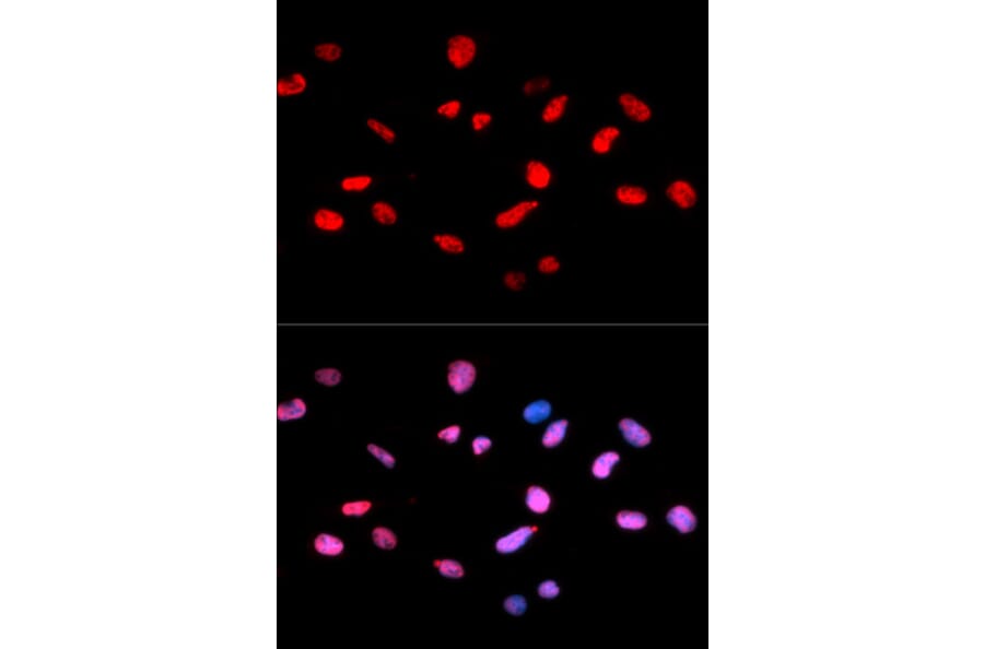 Immunofluorescence - RB (Phospho-Ser811) antibody from Signalway Antibody (12173) - Antibodies.com