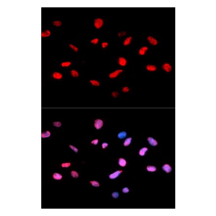 Immunofluorescence - RB (Phospho-Ser811) antibody from Signalway Antibody (12173) - Antibodies.com