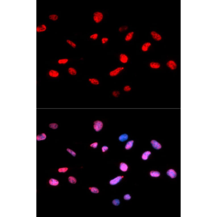 Immunofluorescence - RB (Phospho-Ser811) antibody from Signalway Antibody (12173) - Antibodies.com
