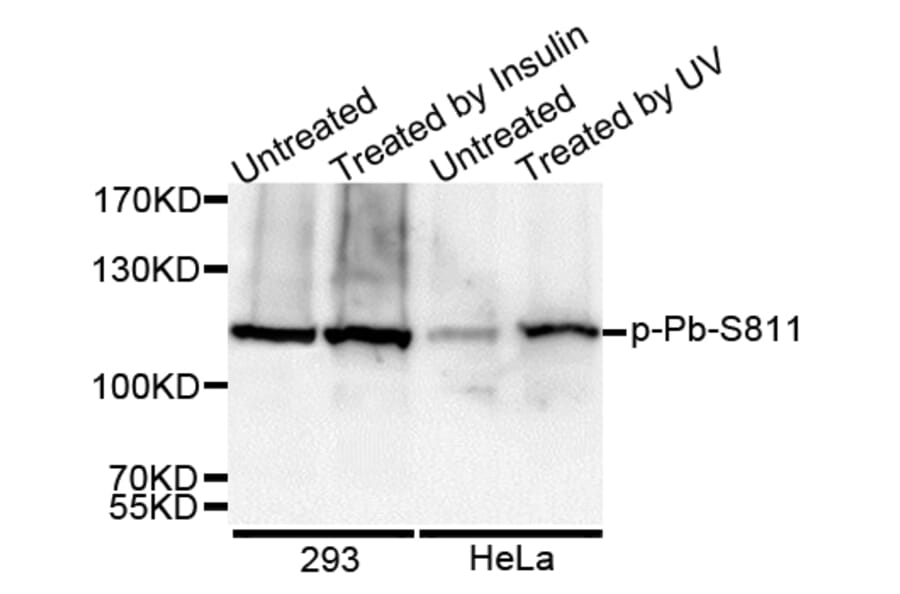 Western blot - RB (Phospho-Ser811) antibody from Signalway Antibody (12173) - Antibodies.com