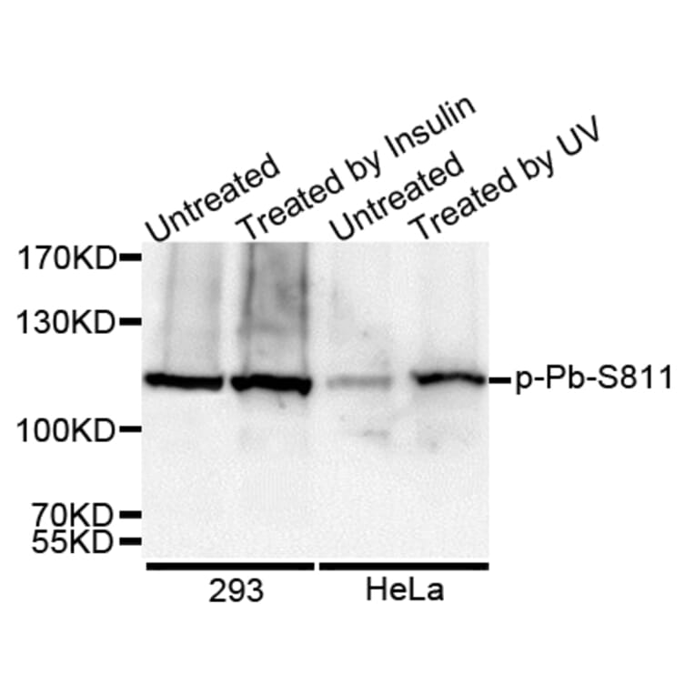Western blot - RB (Phospho-Ser811) antibody from Signalway Antibody (12173) - Antibodies.com