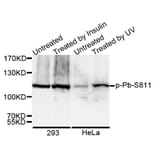 Western blot - RB (Phospho-Ser811) antibody from Signalway Antibody (12173) - Antibodies.com