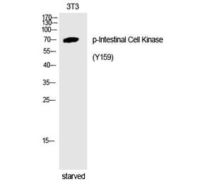 Western blot - Intestinal Cell Kinase (Phospho-Tyr159) Polyclonal Antibody from Signalway Antibody (12254)