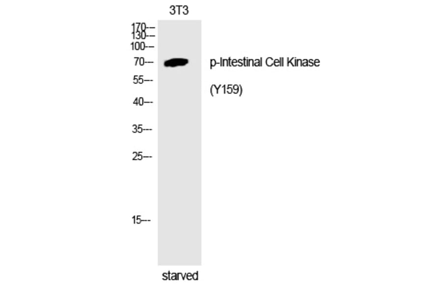 Western blot - Intestinal Cell Kinase (Phospho-Tyr159) Polyclonal Antibody from Signalway Antibody (12254)