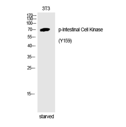 Western blot - Intestinal Cell Kinase (Phospho-Tyr159) Polyclonal Antibody from Signalway Antibody (12254)