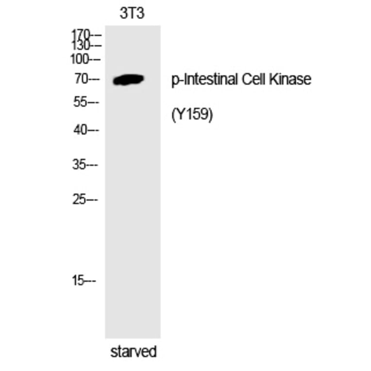 Western blot - Intestinal Cell Kinase (Phospho-Tyr159) Polyclonal Antibody from Signalway Antibody (12254)