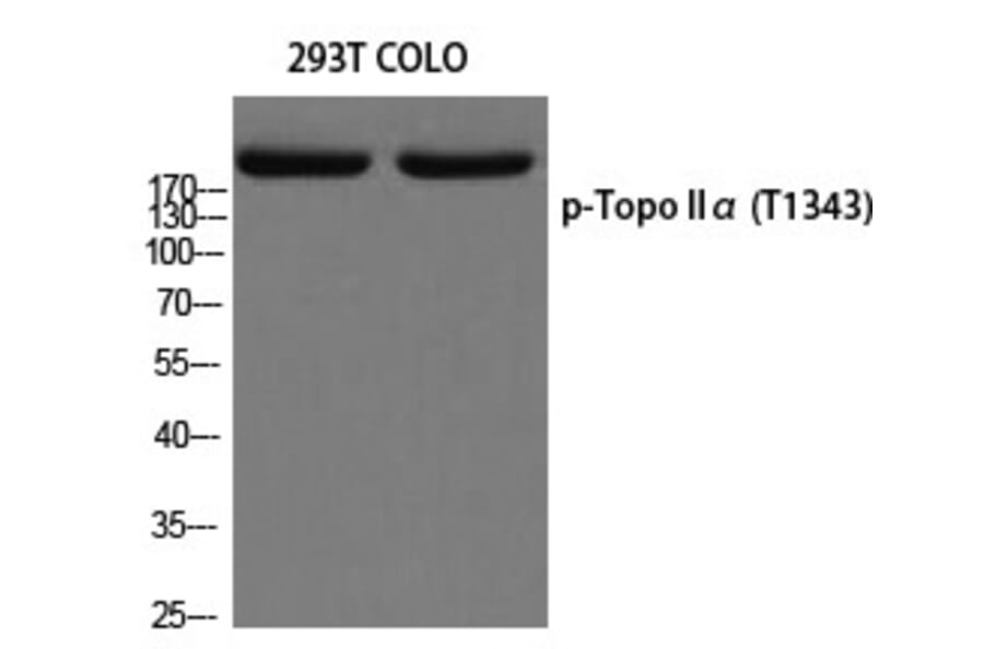 Western blot - Topo IIα (Phospho-Thr1343) Polyclonal Antibody from Signalway Antibody (12259) - Antibodies.com