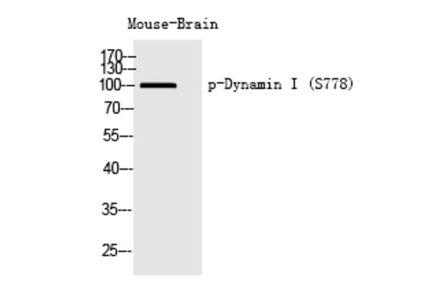 Western blot - Dynamin I (Phospho-Ser778) Polyclonal Antibody from Signalway Antibody (12260) - Antibodies.com