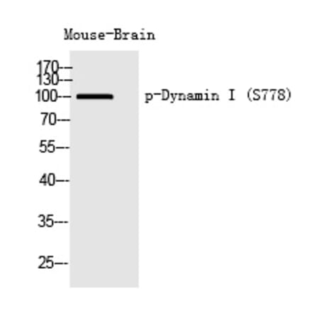 Western blot - Dynamin I (Phospho-Ser778) Polyclonal Antibody from Signalway Antibody (12260) - Antibodies.com