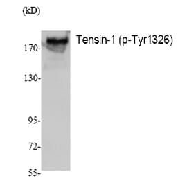 Western blot - Tensin-1 (Phospho-Tyr1326) Polyclonal Antibody from Signalway Antibody (12390) - Antibodies.com