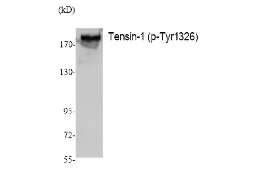 Western blot - Tensin-1 (Phospho-Tyr1326) Polyclonal Antibody from Signalway Antibody (12390) - Antibodies.com