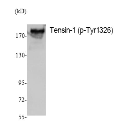 Western blot - Tensin-1 (Phospho-Tyr1326) Polyclonal Antibody from Signalway Antibody (12390) - Antibodies.com