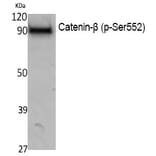 Western blot - Catenin-β (Phospho-Ser552) Polyclonal Antibody from Signalway Antibody (12395) - Antibodies.com