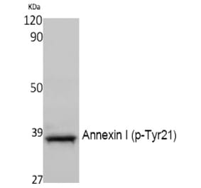 Western blot - Annexin I (Phospho-Tyr21) Polyclonal Antibody from Signalway Antibody (12392) - Antibodies.com