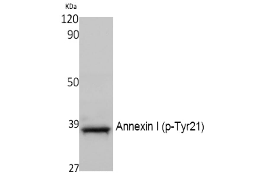 Western blot - Annexin I (Phospho-Tyr21) Polyclonal Antibody from Signalway Antibody (12392) - Antibodies.com
