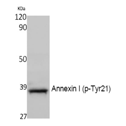 Western blot - Annexin I (Phospho-Tyr21) Polyclonal Antibody from Signalway Antibody (12392) - Antibodies.com