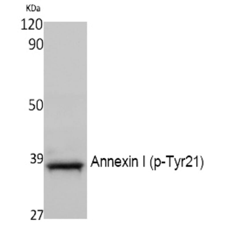 Western blot - Annexin I (Phospho-Tyr21) Polyclonal Antibody from Signalway Antibody (12392) - Antibodies.com