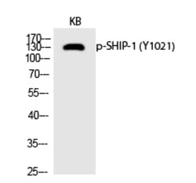 Western blot - SHIP-1 (Phospho-Tyr1021) Polyclonal Antibody from Signalway Antibody (12235) - Antibodies.com