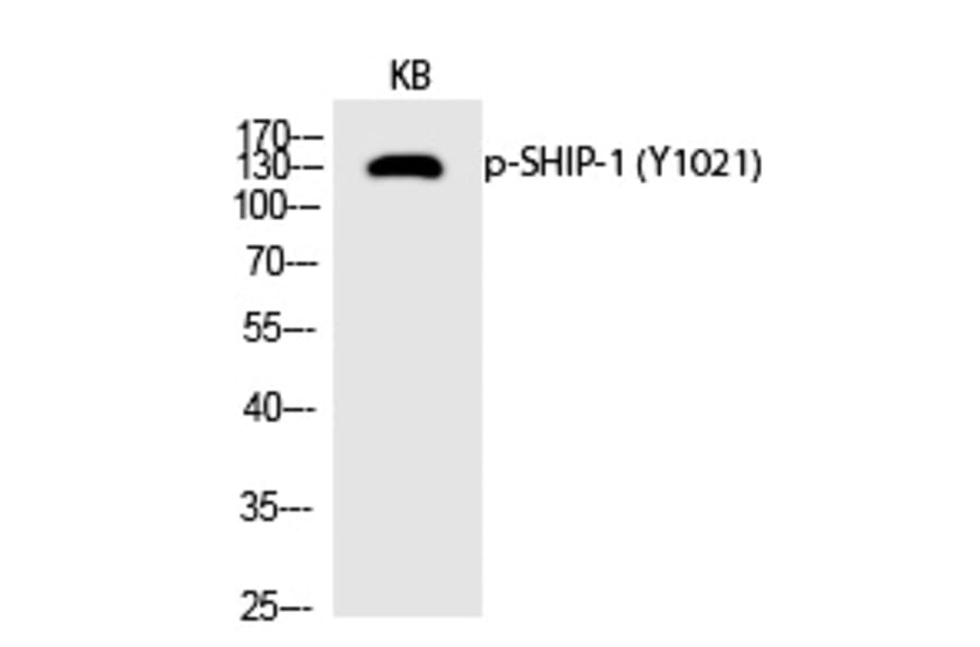 Western blot - SHIP-1 (Phospho-Tyr1021) Polyclonal Antibody from Signalway Antibody (12235) - Antibodies.com